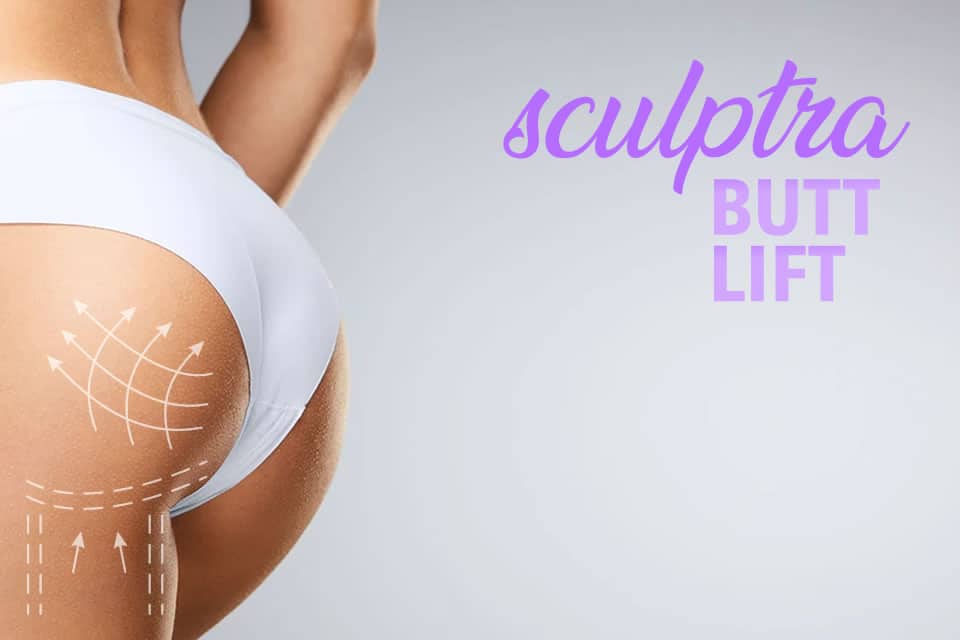 Sculptra Butt Lift
